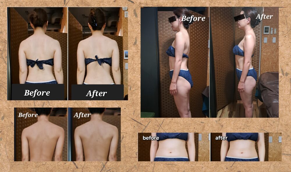 全身深層リンパの施術前と施術後の写真